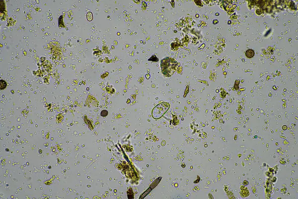 Microorganismos Biología Compost Muestra Suelo Bajo Microscopio Australia —  Fotos de Stock