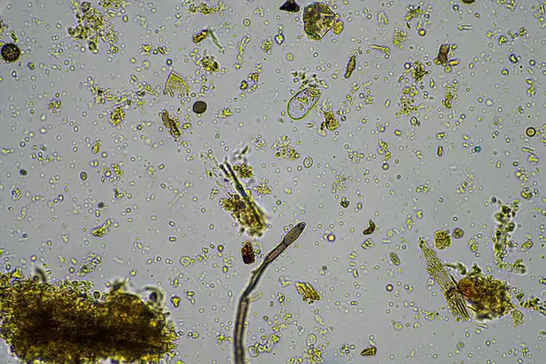 Микроорганизмы Биология Компосте Образце Почвы Микроскопом Австралии — стоковое фото