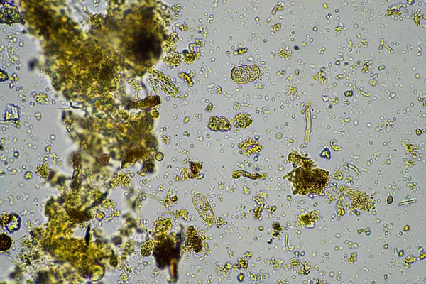 Mikroorganismen Und Biologie Kompost Und Bodenproben Unter Dem Mikroskop Australien — Stockfoto