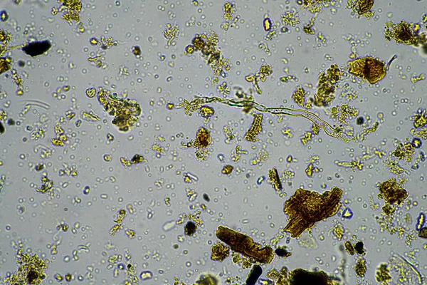 Mikroorganizmy Biologia Próbce Kompostu Gleby Pod Mikroskopem Australii — Zdjęcie stockowe