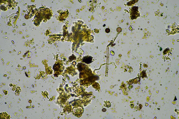Mikroorganizmusok Biológia Komposztban Talajmintában Mikroszkóp Alatt Ausztráliában — Stock Fotó