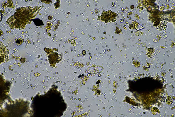 soil microorganisms close up under the microscope. in soil from a farm