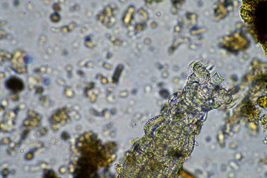 Toprak ve böcekli toprak numunesi olan bir tarım uzmanı. Mantar ve bakterili karbon depolayan mikroorganizmalar 