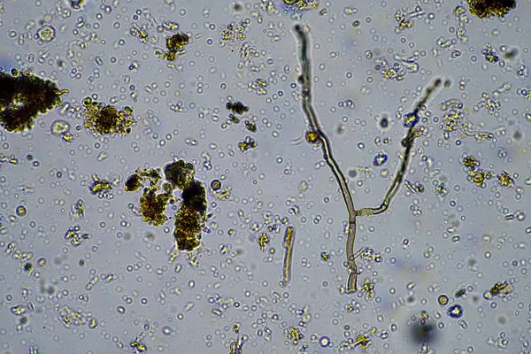 human parasite. gut intestinal infection disease. microorganism infection