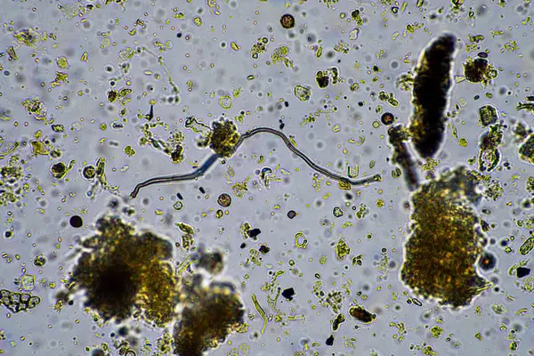 soil microorganisms including nematode, microarthropods, micro arthropod, tardigrade, and rotifers a soil sample, soil fungus and bacteria on a regenerative farm in compost