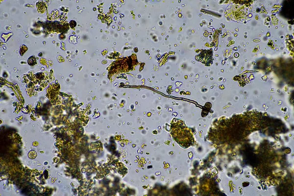 Microorganisms and biology in Compost and soil sample under the microscope in australia in a lab