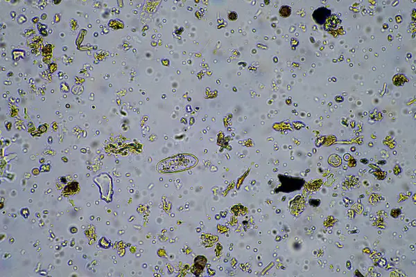 microorganisms and soil biology, with nematodes and fungi under the microscope. in a soil and compost sample in a lab