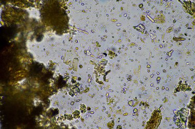 Mikroskopi altında toprak, kum, çamur ve toprak biyolojisi, amip, mantar, mikrop ve bir sığır çiftliğindeki nematodlara bakıyor.