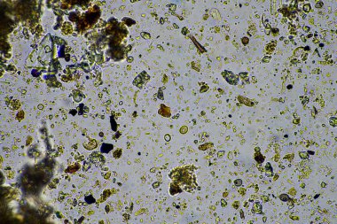 soil microorganisms close up under the microscope. in soil from a farm clipart