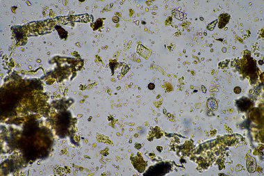 Kompost 'taki mikroorganizmalar ve biyoloji ve Avustralya' daki bir laboratuarda mikroskop altında toprak örneği.