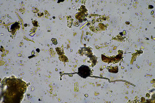 Kompost 'taki mikroorganizmalar ve biyoloji ve Avustralya' daki bir laboratuarda mikroskop altında toprak örneği.