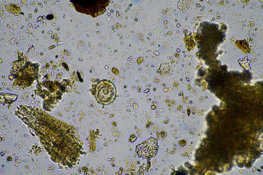 Mikroskopi altında toprak, kum, çamur ve toprak biyolojisi, amip, mantar, mikrop ve bir sığır çiftliğindeki nematodlara bakıyor.