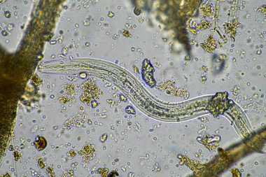 mikroorganizmalar ve toprak biyolojisi, nematodlar ve mantarlarla