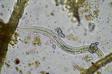 mikroorganizmalar ve toprak biyolojisi, mikroskop altında nematodlar ve mantarlar. Toprakta ve gübrelerde