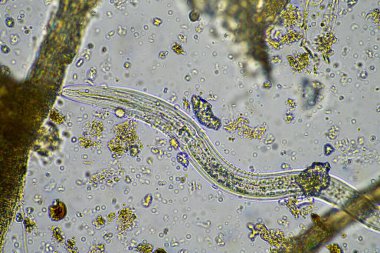 mikroorganizmalar ve toprak biyolojisi, mikroskop altında nematodlar ve mantarlar. Toprakta ve gübrelerde