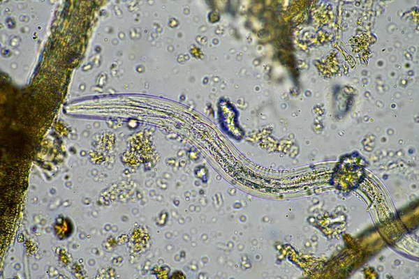 soil microorganisms including nematode, microarthropods, micro arthropod, tardigrade, and rotifers a soil sample, soil fungus and bacteria on a farm in compost under the microscope.