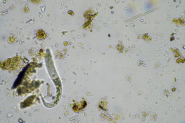 microorganisms and soil biology, with nematodes and fungi under the microscope. in a soil and compost