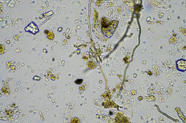 Bir çiftlikteki toprak örneğinde mantar ve mantar hifabesi, mikroorganizmalar ve toprak biyolojisi