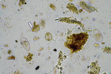 Bir çiftlikteki toprak örneğinde mantar ve mantar hifabesi, mikroorganizmalar ve toprak biyolojisi