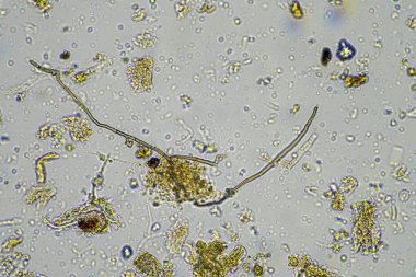 Bir çiftlikteki toprak örneğinde mantar ve mantar hifabesi, mikroorganizmalar ve toprak biyolojisi