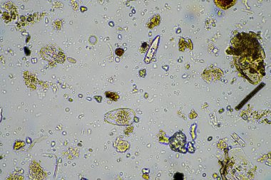 Bir çiftlikteki toprak örneğinde mantar ve mantar hifabesi, mikroorganizmalar ve toprak biyolojisi