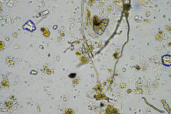 Bir çiftlikteki toprak örneğinde mantar ve mantar hifabesi, mikroorganizmalar ve toprak biyolojisi