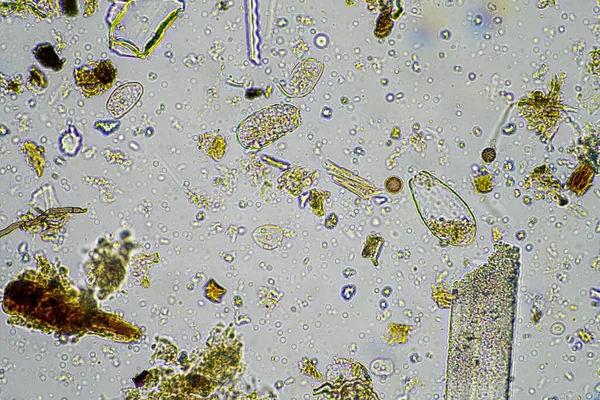fungus and fungal hyphae in a soil sample on a farm, microorganisms and soil biology