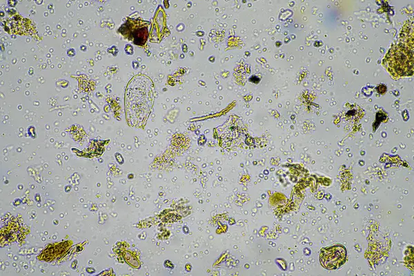 fungal hyphae and soil fungi in a soil sample, showing the living soil from a farm