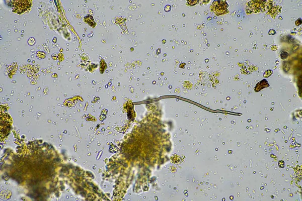 fungus and fungal hyphae in a soil sample on a farm, microorganisms and soil biology
