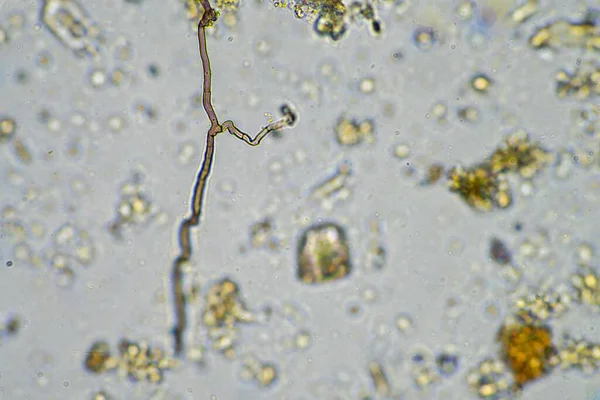 fungal hyphae and soil fungi in a soil sample, showing the living soil from a farm