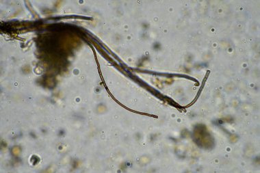 Mikroskop altındaki orman toprağı örneği doğadaki mikroorganizmalara ve mantarlara bakıyor.