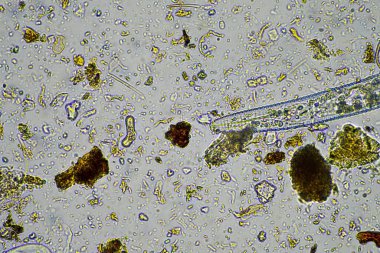 İlkbaharda toprak örneğinde mikroskobik orman mantarı hyphae 'si