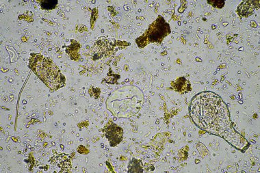 Mikroskop altındaki orman toprağı örneği doğadaki mikroorganizmalara ve mantarlara bakıyor.