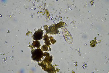 Mikroskop altındaki orman toprağı örneği doğadaki mikroorganizmalara ve mantarlara bakıyor.