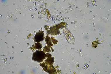 Avustralya 'da sürdürülebilir bir tarım çiftliğinde bakteri, mantar, amip, kırbaç ve arcella içeren toprak örneği. 