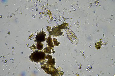 mikroorganizmalar ve toprak biyolojisi, mikroskop altında nematodlar ve mantarlar. Toprakta ve gübrelerde 