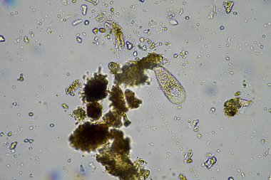 İlkbaharda toprak örneğinde mikroskobik orman mantarı hyphae 'si