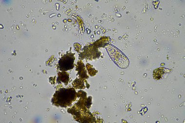 Mikroskop altındaki orman toprağı örneği doğadaki mikroorganizmalara ve mantarlara bakıyor.