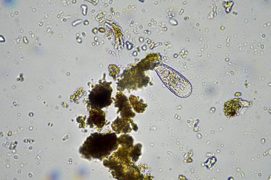 Avustralya 'da sürdürülebilir bir tarım çiftliğinde bakteri, mantar, amip, kırbaç ve arcella içeren toprak örneği. 