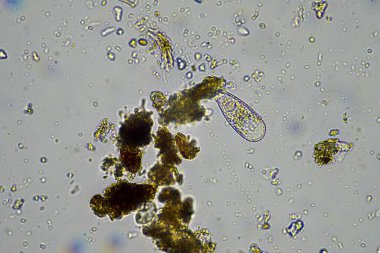mikroorganizmalar ve toprak biyolojisi, mikroskop altında nematodlar ve mantarlar. Toprakta ve gübrelerde 