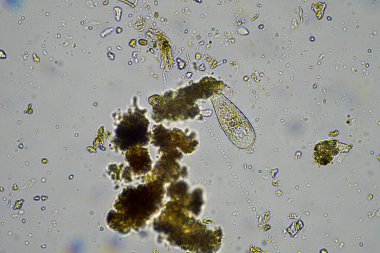 Mikroskop altındaki orman toprağı örneği doğadaki mikroorganizmalara ve mantarlara bakıyor.