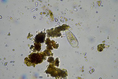 Avustralya 'da sürdürülebilir bir tarım çiftliğinde bakteri, mantar, amip, kırbaç ve arcella içeren toprak örneği. 