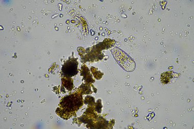 İlkbaharda toprak örneğinde mikroskobik orman mantarı hyphae 'si