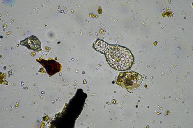mikroorganizmalar ve toprak biyolojisi, mikroskop altında nematodlar ve mantarlar. Toprakta ve gübrelerde 