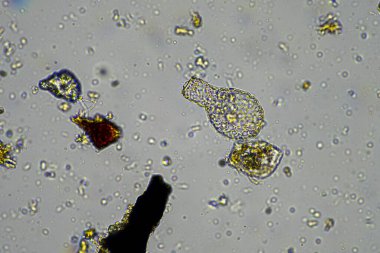 İlkbaharda toprak örneğinde mikroskobik orman mantarı hyphae 'si