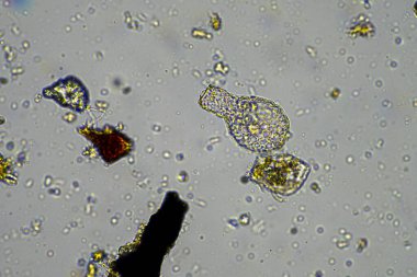 Mikroskop altındaki orman toprağı örneği doğadaki mikroorganizmalara ve mantarlara bakıyor.