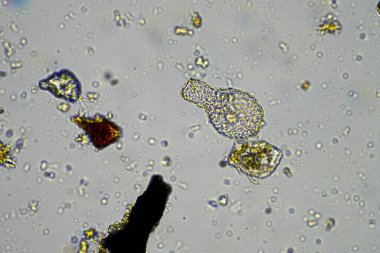 Avustralya 'da sürdürülebilir bir tarım çiftliğinde bakteri, mantar, amip, kırbaç ve arcella içeren toprak örneği. 