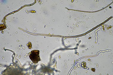 İlkbaharda toprak örneğinde mikroskobik orman mantarı hyphae 'si