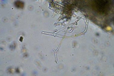 Mikroskop altındaki orman toprağı örneği doğadaki mikroorganizmalara ve mantarlara bakıyor.