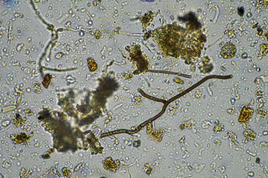 Mikroskop altındaki orman toprağı örneği doğadaki mikroorganizmalara ve mantarlara bakıyor.